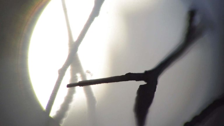 allonen_txe_injection_2-0-2