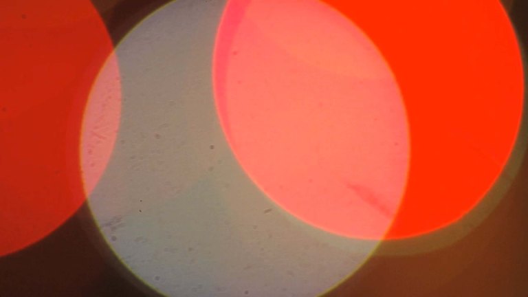 allonen_txe_injection_2-0